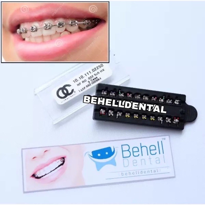 ORI | BRACKET BEHEL METAL ORTHO CLASSIC USA | ROTH KAWAT PERMANEN PERBAIKAN GIGI ORTHOCLASSIC DENTAL