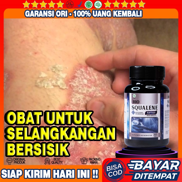 Obat Selangkangan Kering Bersisik - Obat Kulit Tangan Bersisik - Obat Kulit Kaki Bersisik - Obat Kul