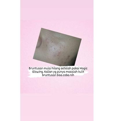 Terbaru paket glow up by MG WZ49 ➣