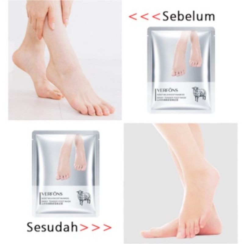 1 Pasang Masker Kaki CINDYNAL/EFERO FOOT MASK Masker Kaki Peeling