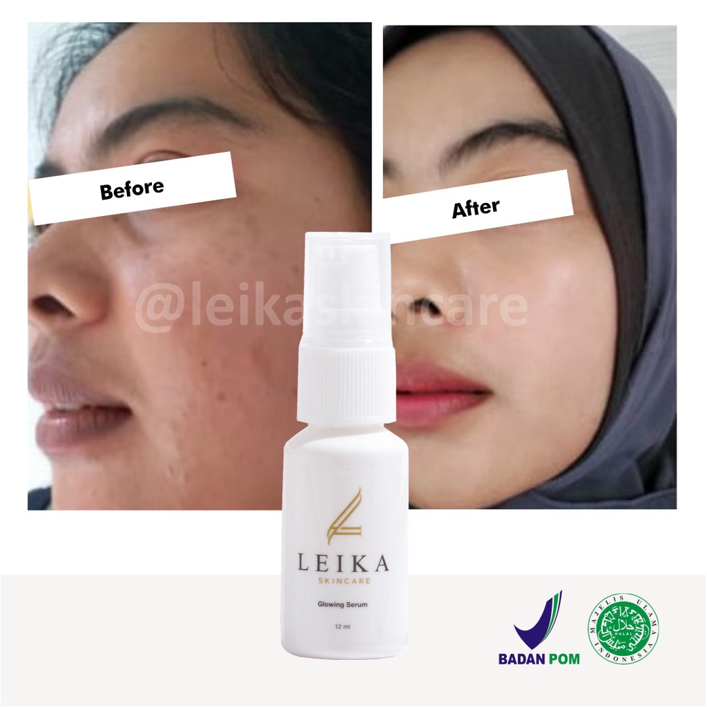 Wow! Serum Glowing Pencerah Kulit Wajah Serum Pencerah Wajah Kusam Murah Ampuh Serum Pencerah Wajah Berminyak Glowing Serum Leika Skincare 12ml korea cepat Asli BPOM dan Halal