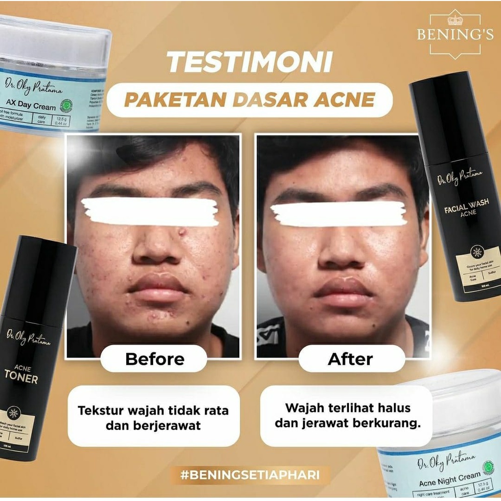 Bening's Promo Acne Skincare (okyslim trial) | Paketan Jerawat dan Beruntusan-5