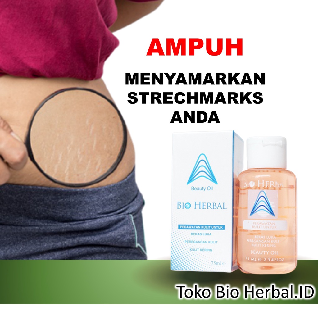 Obat Strechmark Paling Ampuh Penghilang Bekas Luka Dan Jerawat B8P