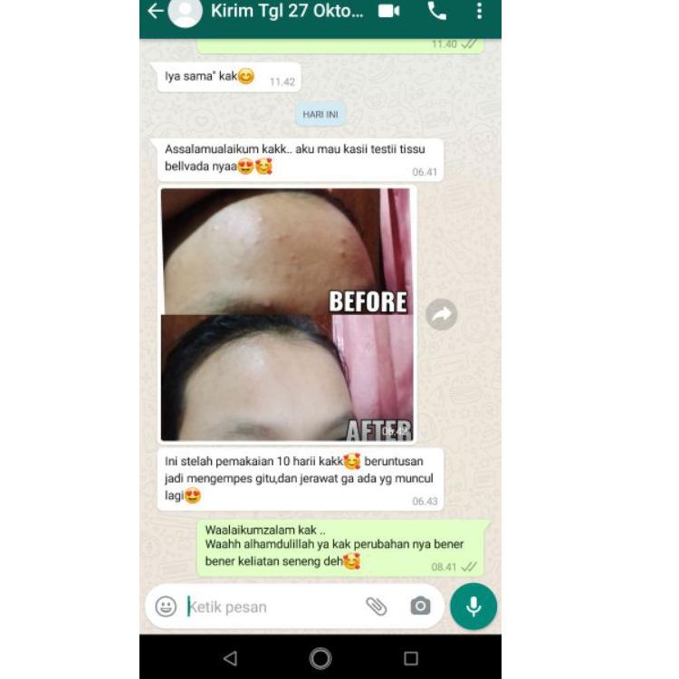 Bagus Banget.. BELI 2 KIRIM 3 Tissue BELLVADA Whitening / Ultimate Tissu Bellvada Tissu Original ASL