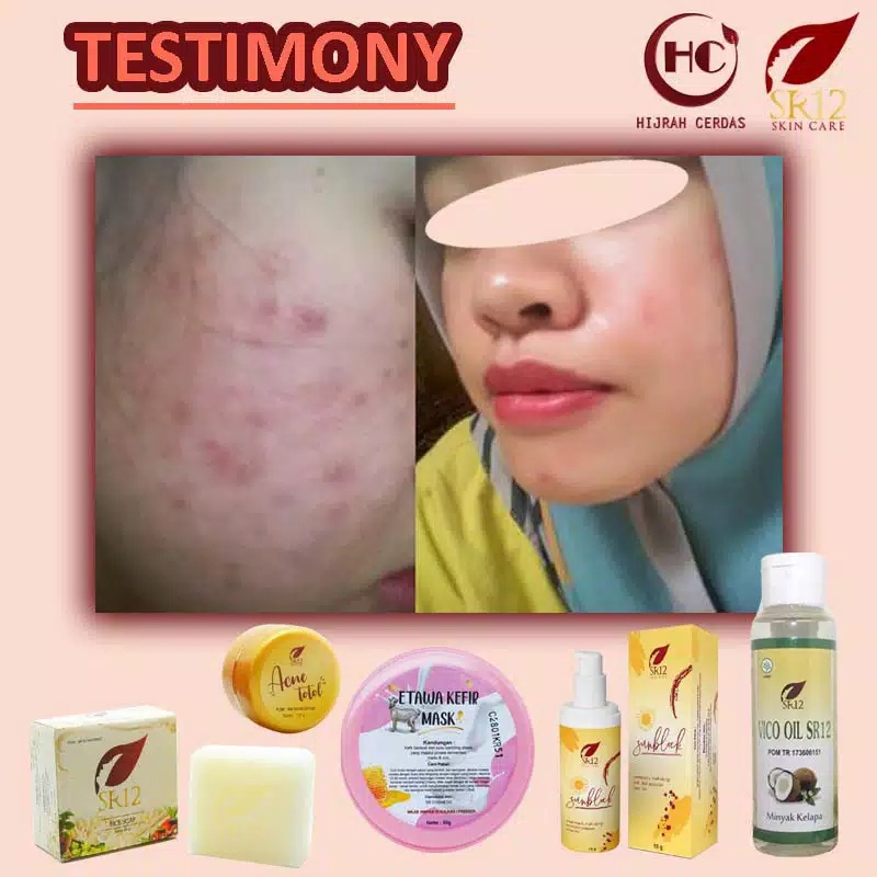 ETAWA KEFIR MASK SR12 BPOM/KEFIR ETAWA MASK SR12/KULIT BERMINYAK&amp;BERJERAWAT/KEFIR MASK SUSU KAMBING