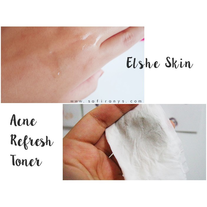 ELSHESKIN Acne Refresh Toner 100ml