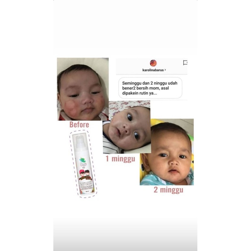 Beauty Barn Kids SKIN SOOTHER STICK  (Salep Anak Alami Serbaguna)