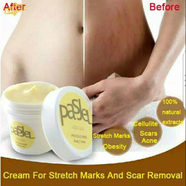 Ready Cream Pemutih Penghilang Stretch Maks Untuk Ibu Hamil