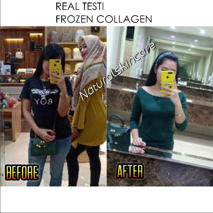 ASLI PROMO FROZEN COLLAGEN & LAZEL GLUTA PURE - ORIGINAL 100% 