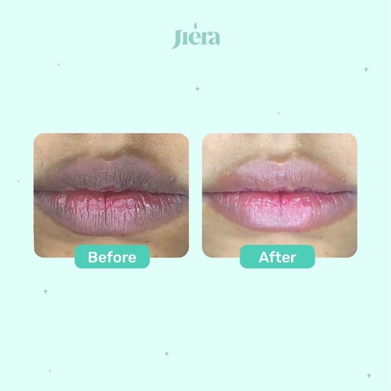 JIERA Natural Lip Serum BPOM 10ml / 20ml ORIGINAL 100% - Pencerah Bibir Hitam, Serum Bibir, Pelembab Bibir