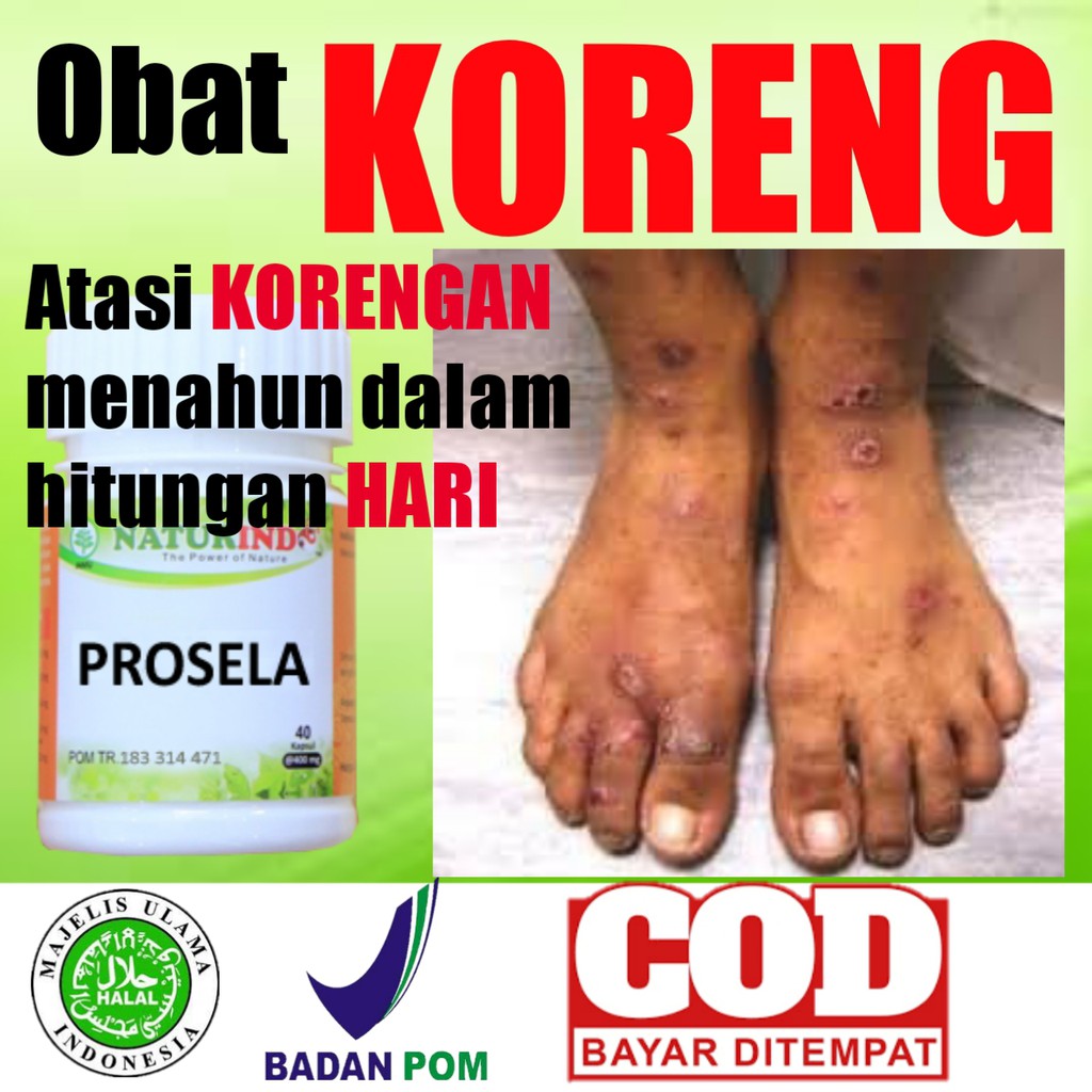 OBAT KORENG BOROK KULIT MENGHITAM GATAL-GATAL BEKAS JERAWAT BEKAS LUKA LAMA PALING AMPUH HERBAL NATU