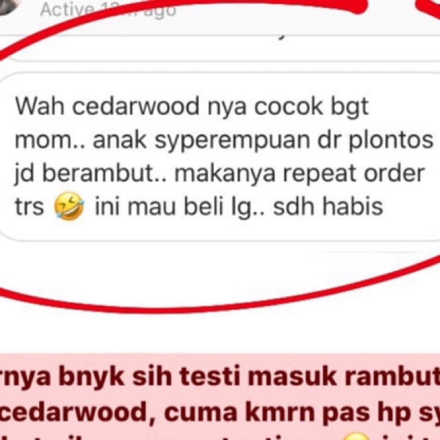 CEDARWOOD Essential Oil + Evoo minyak zaitun. Obat herbal alami anak. Penumbuh pelebat rambut tipis