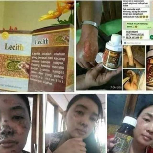 

Lecithin