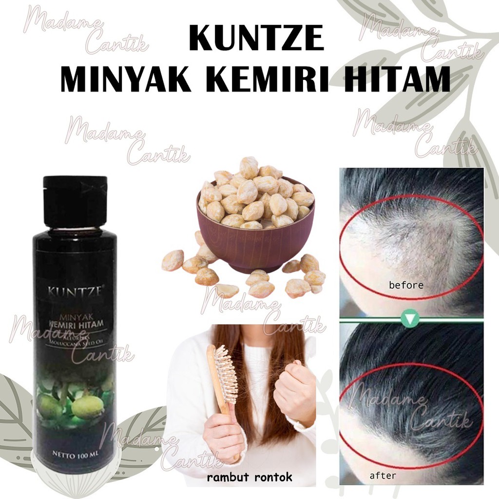 ✿ MADAME ✿ KUNTZE MINYAK KEMIRI HITAM - PENUMBUH RAMBUT