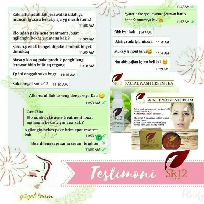 Sr12 Acne Treatment Cream - Perawatan Jerawat Untuk Muka Wajah Diskon