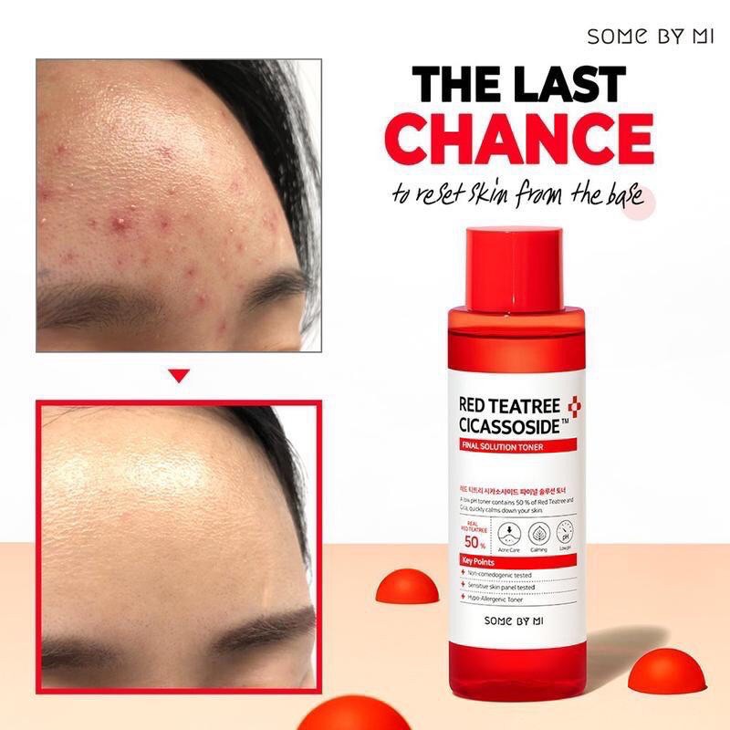 SOMEBYMI/ SOME BY MI Red Tea Tree Cicasoside Toner 150ml- Toner Wajah- Original Bersegel