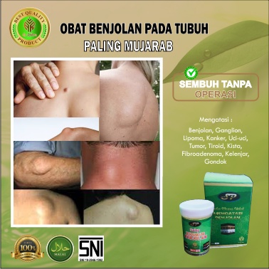 SP AR-RAIHAN ( salep benjolan racikan dokter ) ATASI BENJOLAN - SALEP BENJOLAN - KISTA - SALEP GONDOK - TUMOR - UCI UCI - kista - limpoma .benjolan dileher - benjolan di tangan - benjolan di payudara - kista -  - minyak  benjolan