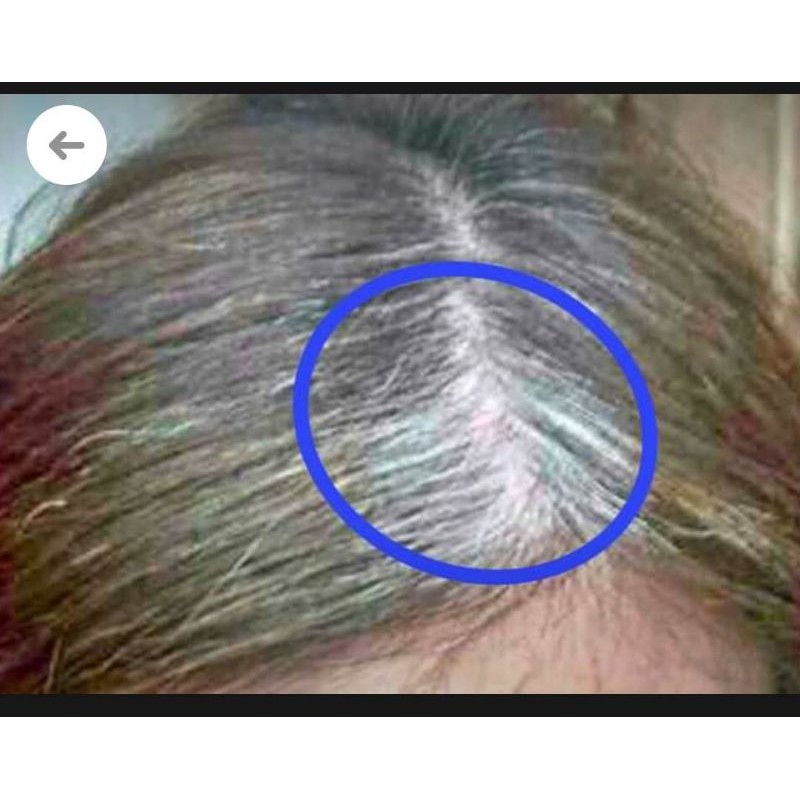 paket atasi uban,rambut bebas uban tampa semir