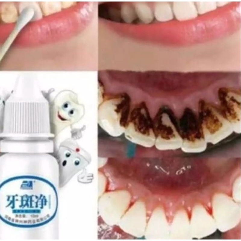 PEMUTIH GIGI PENGHILANG PLAK KARANG GIGI YABAJING TEETH WHITENING DIJAMIN ORIGINAL