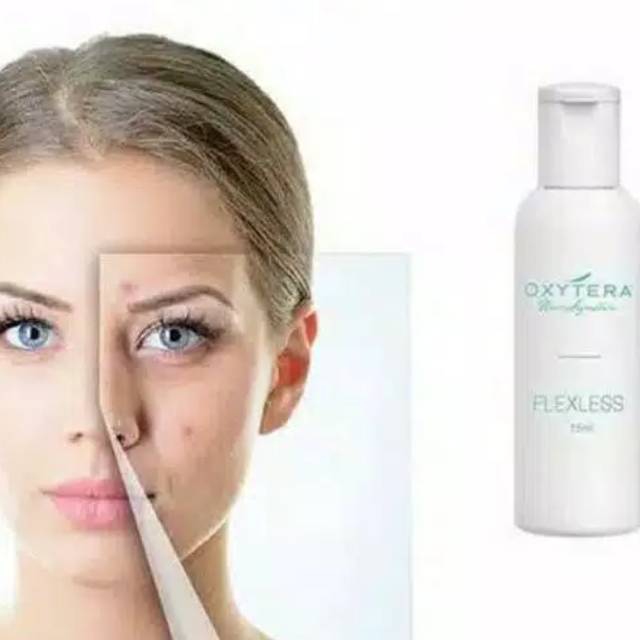Oxytera New Signature Fx Flek