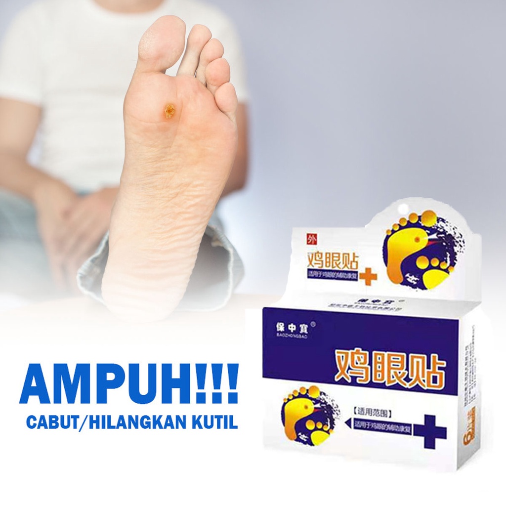 SHINE STAR - [1 BOX 6 PCS]  PLESTER OBAT MATA IKAN KAKI KUTIL DAN KAPALAN AMPUH MENGOBATI KUTIL DAN MATA IKAN