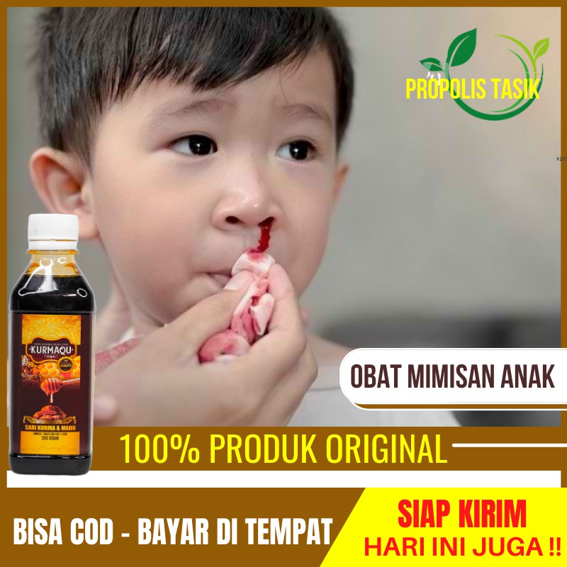 Jual Obat Mimisan Pada Anak Epistaksis Pembuluh Darah Pecah