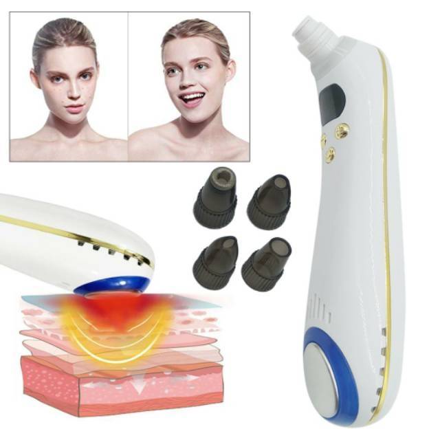 Setrika wajah hot &amp; cool alat penyedot komedo + dermabrasi 3in1