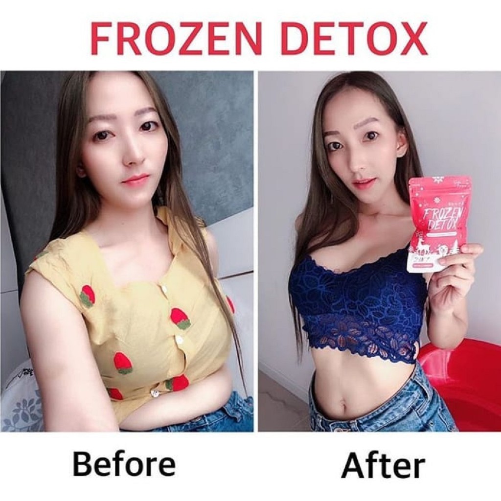 Frozen Detox by Gluta Frozen Collagen Dietary Supplement