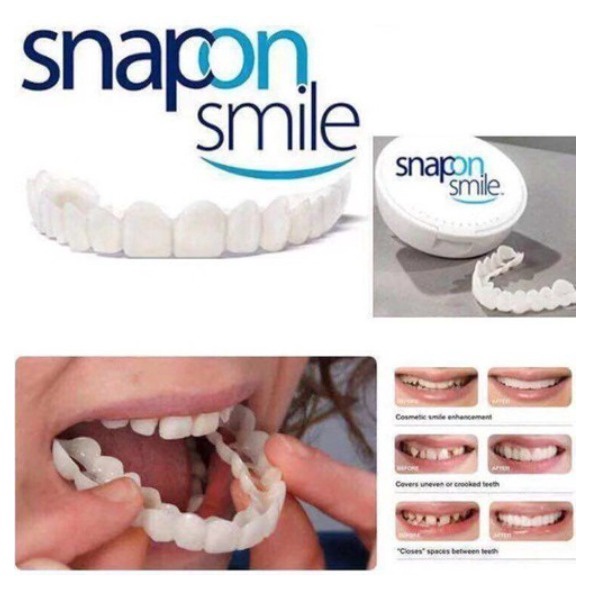 1 Set Atas Bawah Snap On Smile Gigi Tiruan putih seperti gigi asli Gigi Palsu Silikon