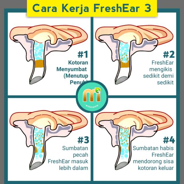 FRESH EAR : OBAT PEMBERSIH TELINGA EFEKTIF DAN AMAN ( EAR CLEANER )