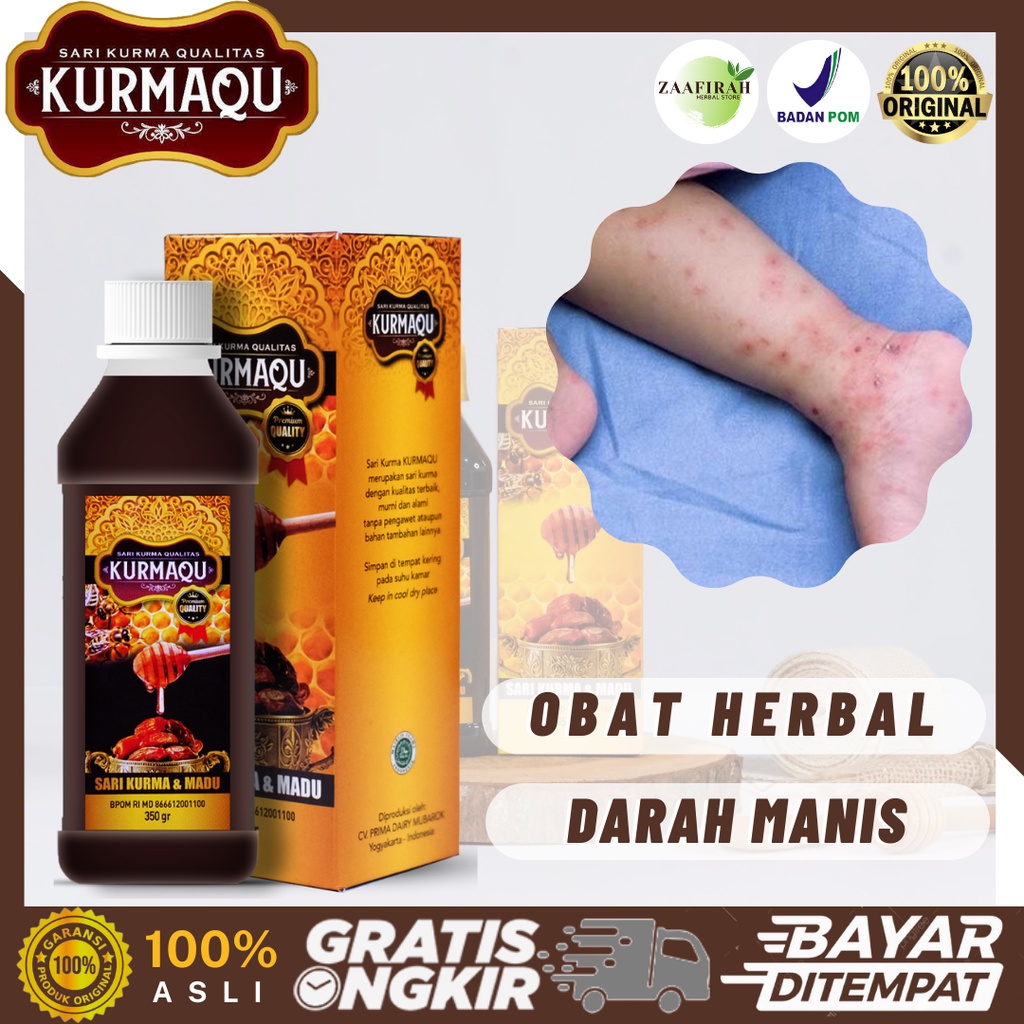 Kurmaqu Sari Kurma Dan Madu Original BPOM Obat Darah Manis Gatal Darah Manis Prurigo Gatal Gatal Sel