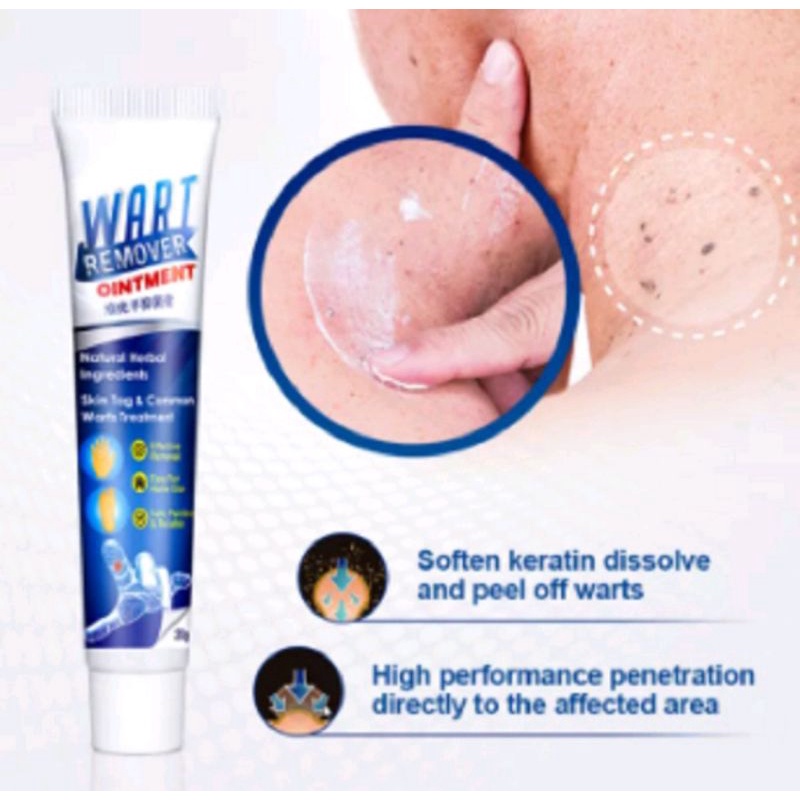 WART REMOVER OBAT KUTIL OBAT TAHI LALAT MATA IKAN