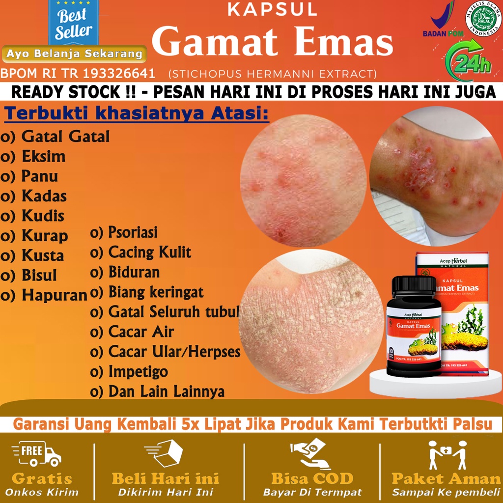 Jual Obat Solusi Mengatasi Gatal Gatal Eksim Kadas Kudis Kurap Hapuran Bisul Cacing Kulit