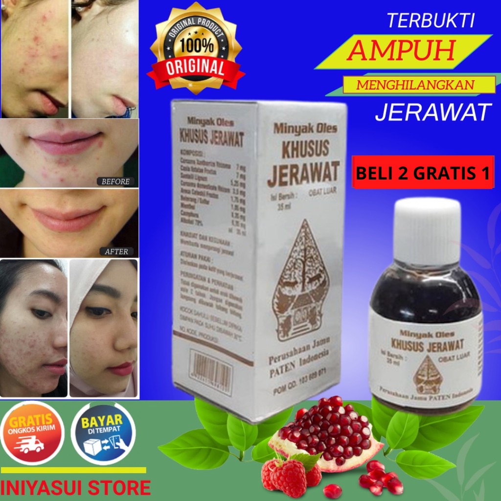 Obat Jerawat Penghilang Punggung Badan Wajah Berjerawat Pembersih Herbal Paling Ampuh ORIGINAL