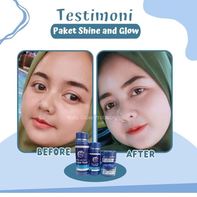 ㊤X SKINCARE BPOM NALUGLOW || NALU GLOW SKINCARE WHITENING || KRIM JERAWAT || KRIM FLEK DARK SPOT AMA