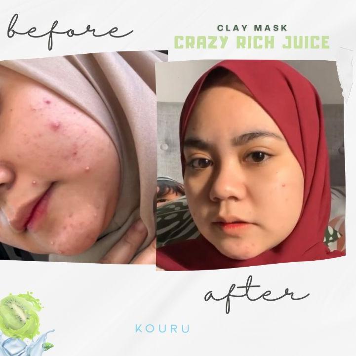 {N-AGW> {☀> KOURU Crazy Rich Juice Clay Mask 125gr {top produk>