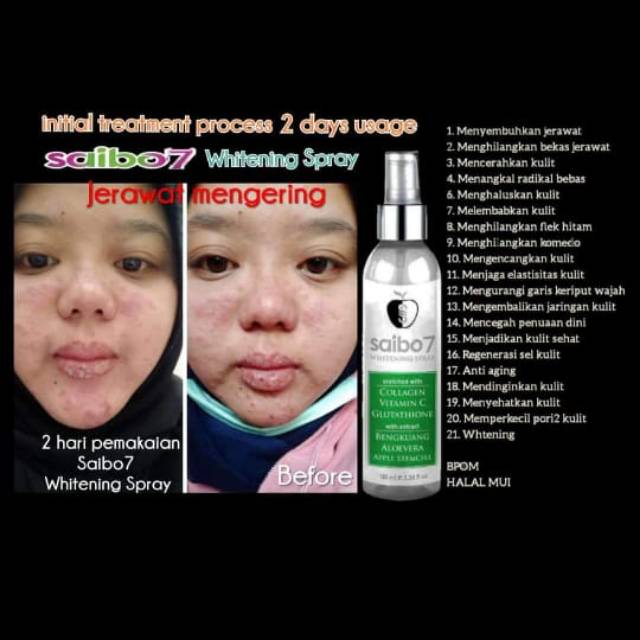 Spray Whitening