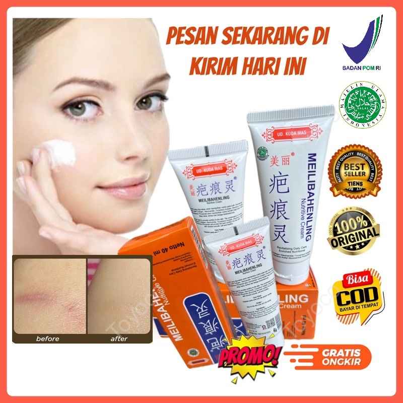 Cream Melibahenling Original Meilibahenling Original 100% Salep Penghilang Bekas Luka Hitam Meibahenling Original Penghilang Bekas Luka Di Kaki Salep Meilibahenling Original