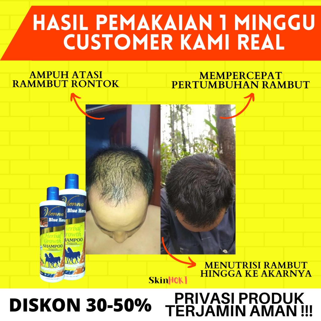 SAMPO KUDA PEMANJANG RAMBUT PENEBAL RAMBUT VIENNA BLUE HORSE HERBAL GROWTH SHAMPOO 350ML PENUMBUH RAMBUT ORIGINAL BPOM