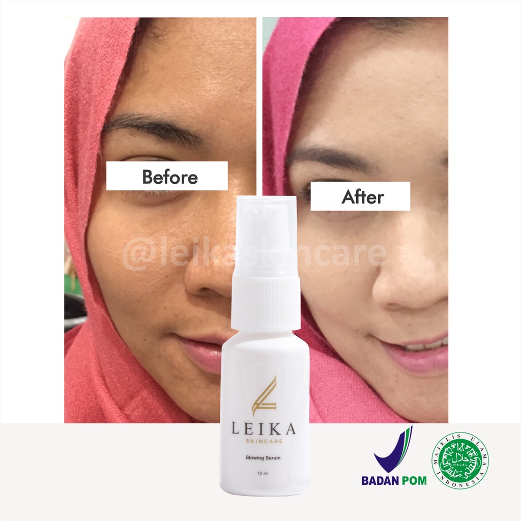 Wow! Serum Glowing Pencerah Kulit Wajah Serum Pencerah Wajah Kusam Murah Ampuh Serum Pencerah Wajah Berminyak Glowing Serum Leika Skincare 12ml korea cepat Asli BPOM dan Halal