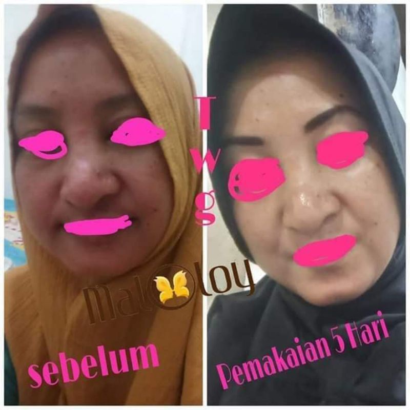 MALOLOY SKINCARE || HANYA CREAM