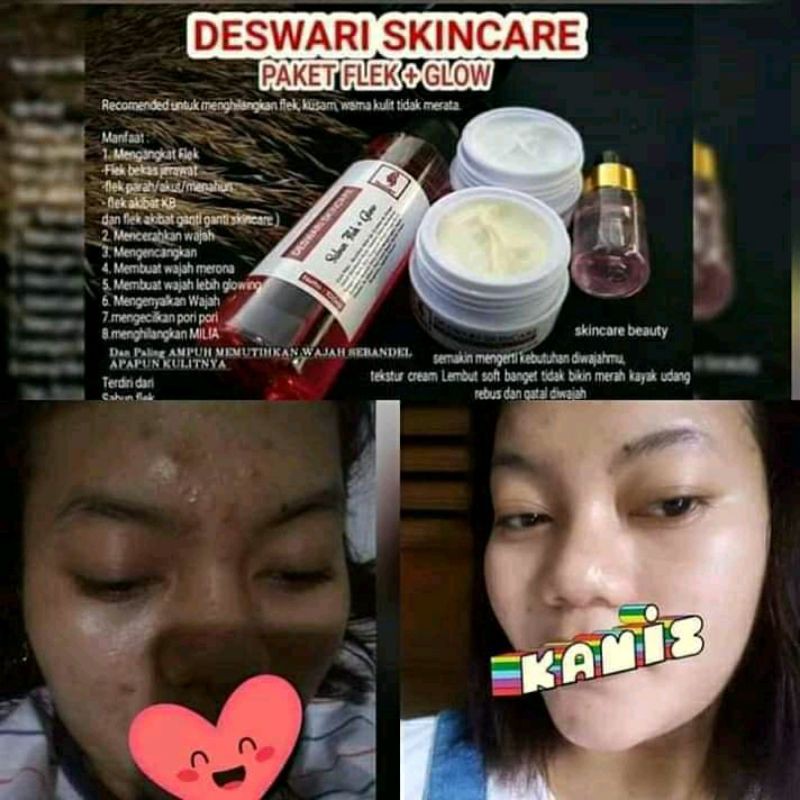 deswari skincare paket flek