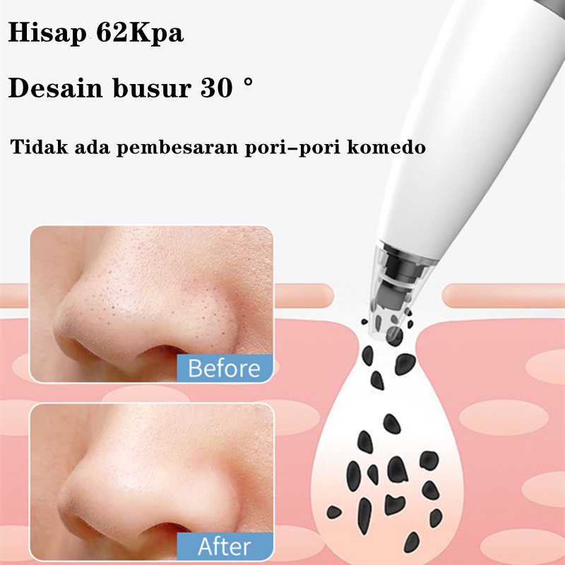 Inface MS7000 Alat Penyedot Komedo dan Jerawat Elektrik Blackhead Remover 4 Nozel Mesin Penghilang Penyedot Komedo Wajah