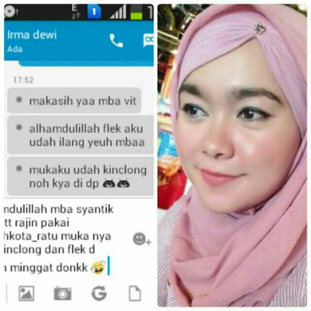 Mahkota ratu paket flek