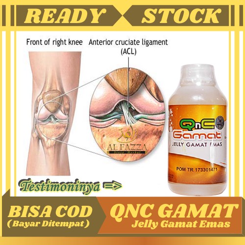 Obat Nyeri Sendi Lutut, Cidera Lutut, Cedera Acl / Ligamen Lutut Anterior, Sakit Otot, Ligamen Robek