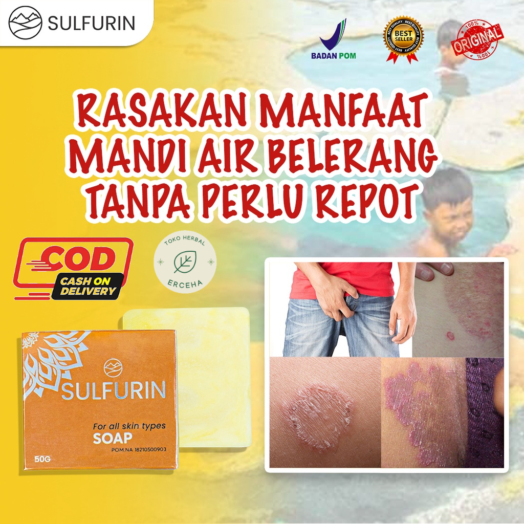 Sabun Sulfurin Belerang Sabun Belerang Untuk Gatal Pada Selangkangan Bokong Kutil Sabun Gatal Kulit Tangan Kaki Aman Sudah BPOM