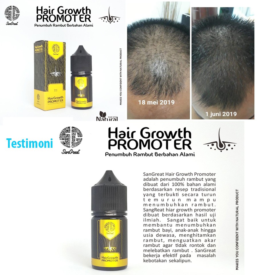 SanGreat Serum Rambut Penumbuh Rambut Alami Anak &amp; Dewasa