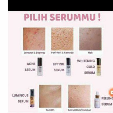 SERUM MS GLOW TERLENGKAP