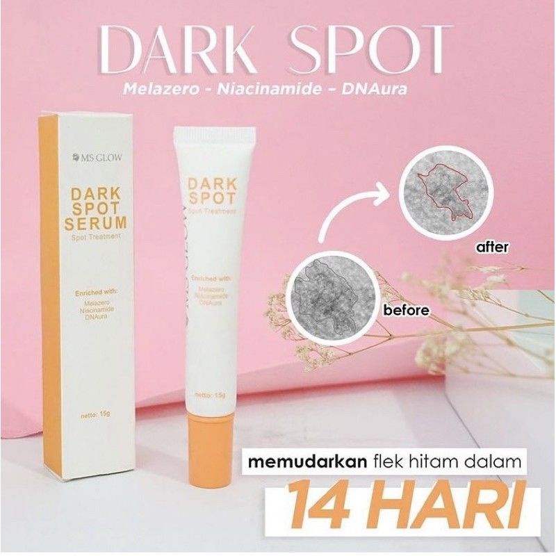 Dark spot Ms glow original menghilangkan flek Hitam