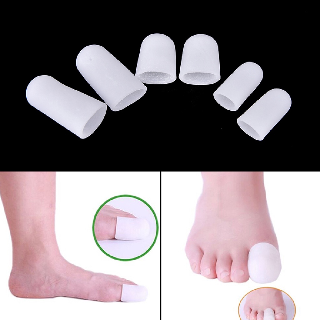 Gongjing1 2Pcs Perban Pelindung Jari Kaki Bahan Silikon Gel